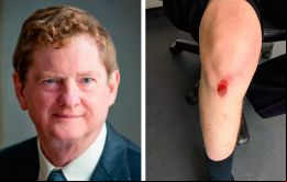El periodista canadiense y su herida tras el atraco. (Fotos de la cuenta personal de John Kirton en Twitter)