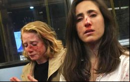 La paliza fue de tal magnitud y violencia que las dejaron ensangrentadas y casi inconscientes en el autobús. Incluso, Geyomat sufrió la fractura de su tabique nasal.