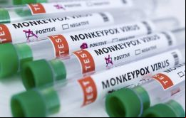 La UKHSA anunció que había detectado 71 nuevos casos de viruela del mono entre los seres humanos en Inglaterra