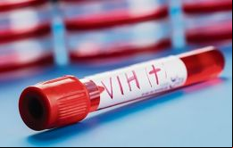 Actualmente, 17.156 personas viven con el VIH en Paraguay
