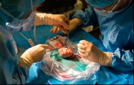 Los xenotrasplantes ofrecen nuevas posibilidades a los pacientes que necesitan órganos
