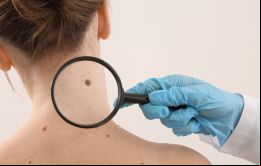 Bajo el eslogan Be Sun Safe, se explica que la radiación UV del sol es causa mayor del cáncer de piel en las Islas, pero también la mejor fuente de Vitamina D